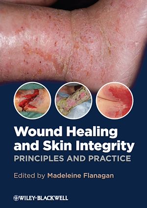 Download the eBook: Wound Healing and Skin Integrity
