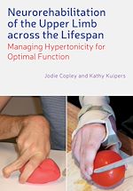 Download this eBook Neurorehabilitation of the Upper Limb Across the Lifespan