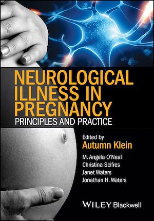 Download the eBook: Neurological Illness in Pregnancy