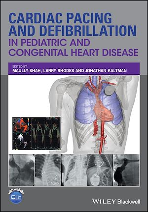Download the eBook: Cardiac Pacing and Defibrillation in Pediatric and Congenital Heart Disease