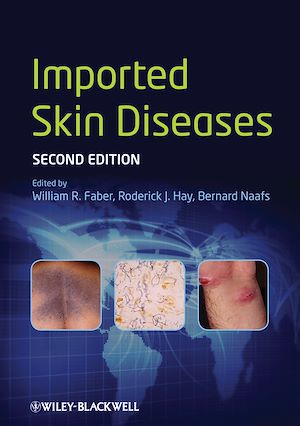 Téléchargez le livre :  Imported Skin Diseases