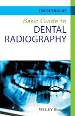 Télécharger le livre :  Basic Guide to Dental Radiography