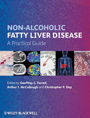 Téléchargez le livre :  Non-Alcoholic Fatty Liver Disease
