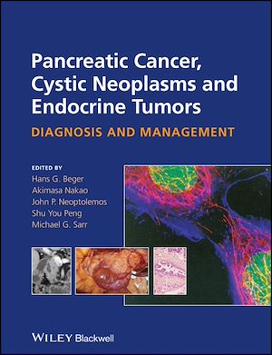 Download the eBook: Pancreatic Cancer, Cystic Neoplasms and Endocrine Tumors