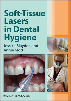 Téléchargez le livre :  Soft-Tissue Lasers in Dental Hygiene