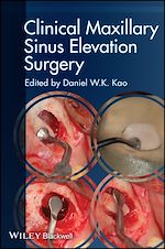 Télécharger le livre :  Clinical Maxillary Sinus Elevation Surgery
