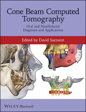 Download the eBook: Cone Beam Computed Tomography