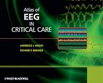 Télécharger le livre :  Atlas of EEG in Critical Care