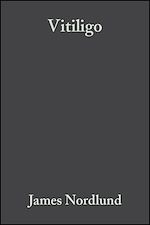 Télécharger le livre :  Vitiligo