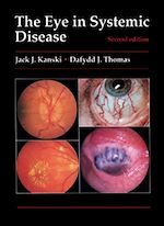Télécharger le livre :  The Eye in Systemic Disease