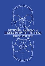 Télécharger le livre :  Sectional Anatomy and Tomography of the Head