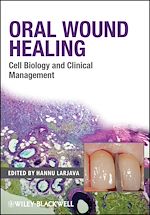 Télécharger le livre :  Oral Wound Healing
