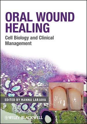 Téléchargez le livre :  Oral Wound Healing