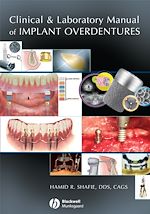 Download this eBook Clinical and Laboratory Manual of Implant Overdentures