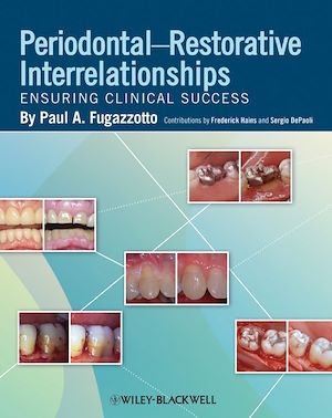 Téléchargez le livre :  Periodontal-Restorative Interrelationships