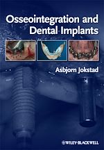 Télécharger le livre :  Osseointegration and Dental Implants