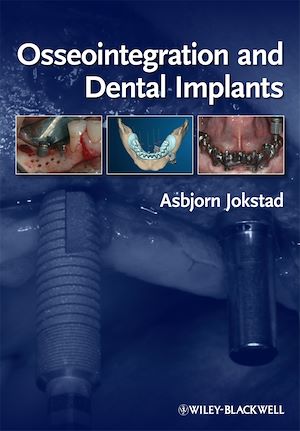 Téléchargez le livre :  Osseointegration and Dental Implants
