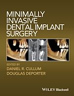 Télécharger le livre :  Minimally Invasive Dental Implant Surgery