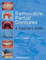 Télécharger le livre :  Removable Partial Dentures