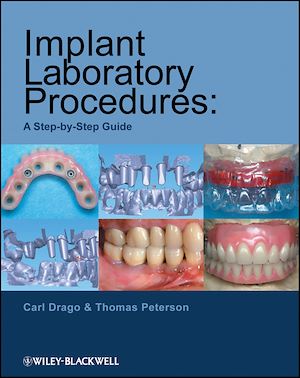 Download the eBook: Implant Laboratory Procedures