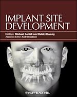 Télécharger le livre :  Implant Site Development