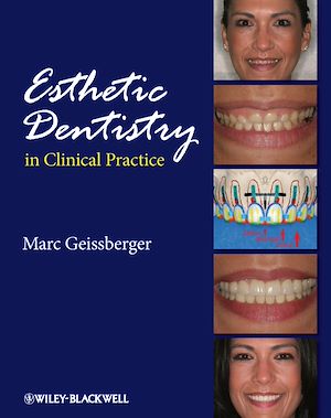 Download the eBook: Esthetic Dentistry in Clinical Practice
