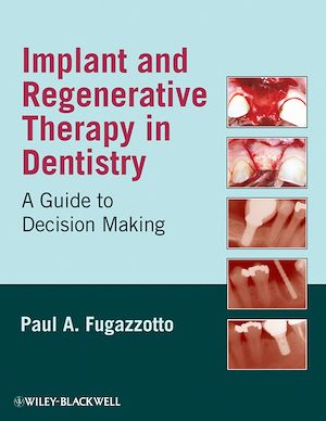 Téléchargez le livre :  Implant and Regenerative Therapy in Dentistry