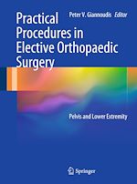 Télécharger le livre :  Practical Procedures in Elective Orthopaedic Surgery