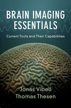 Download the eBook: Brain Imaging Essentials