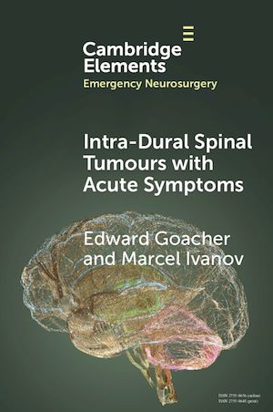 Download the eBook: Intra-dural Spinal Tumours with Acute Symptoms
