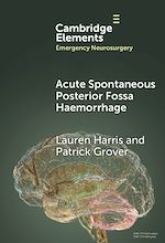 Download this eBook Acute Spontaneous Posterior Fossa Haemorrhage