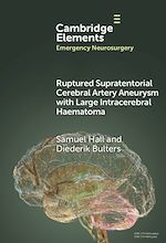 Télécharger le livre :  Ruptured Supratentorial Cerebral Artery Aneurysm with Large Intracerebral Haematoma