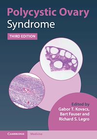 Téléchargez le livre :  Polycystic Ovary Syndrome