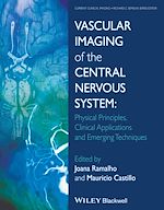Télécharger le livre :  Vascular Imaging of the Central Nervous System