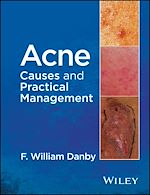 Download this eBook Acne