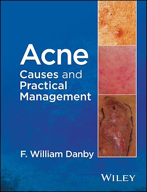 Download the eBook: Acne