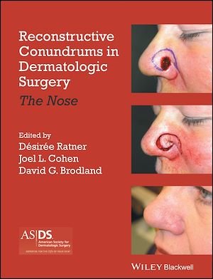 Download the eBook: Reconstructive Conundrums in Dermatologic Surgery