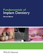Télécharger le livre :  Fundamentals of Implant Dentistry