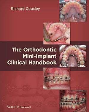 Téléchargez le livre :  The Orthodontic Mini-implant Clinical Handbook