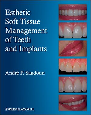 Téléchargez le livre :  Esthetic Soft Tissue Management of Teeth and Implants