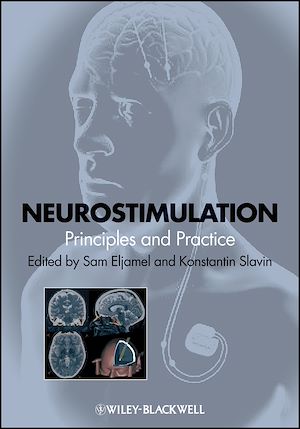 Download the eBook: Neurostimulation