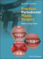 Télécharger le livre :  Practical Periodontal Plastic Surgery