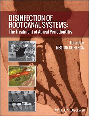 Download the eBook: Disinfection of Root Canal Systems
