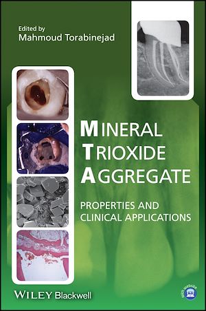 Download the eBook: Mineral Trioxide Aggregate