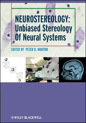 Download the eBook: Neurostereology
