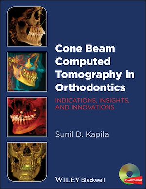 Téléchargez le livre :  Cone Beam Computed Tomography in Orthodontics