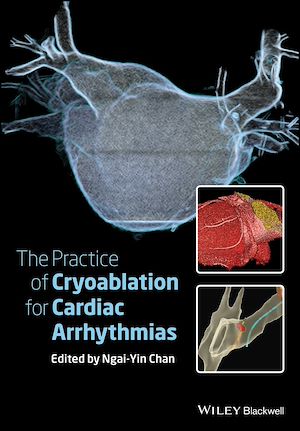 Download the eBook: The Practice of Catheter Cryoablation for Cardiac Arrhythmias