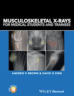 Télécharger le livre :  Musculoskeletal X-Rays for Medical Students and Trainees