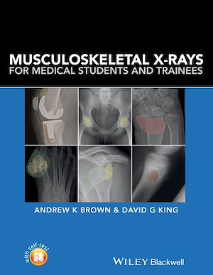 Téléchargez le livre :  Musculoskeletal X-Rays for Medical Students and Trainees
