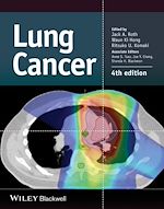 Télécharger le livre :  Lung Cancer